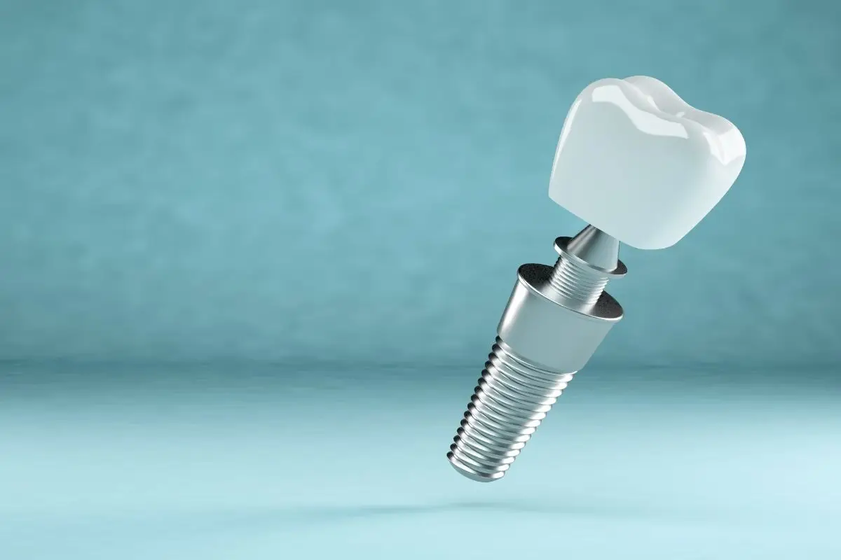 Implants dentaires Tous sur 6 en Turquie