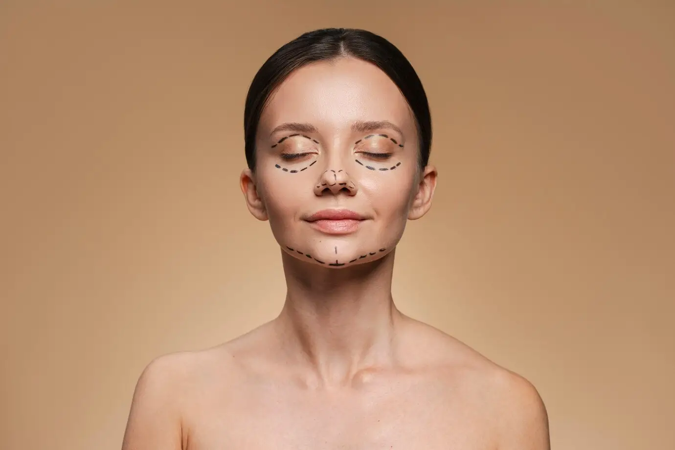 Lifting du milieu du visage