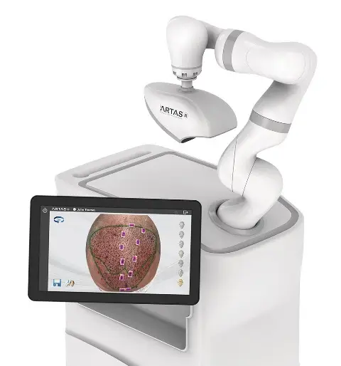 Greffe de cheveux robotisée | Précision et technologie