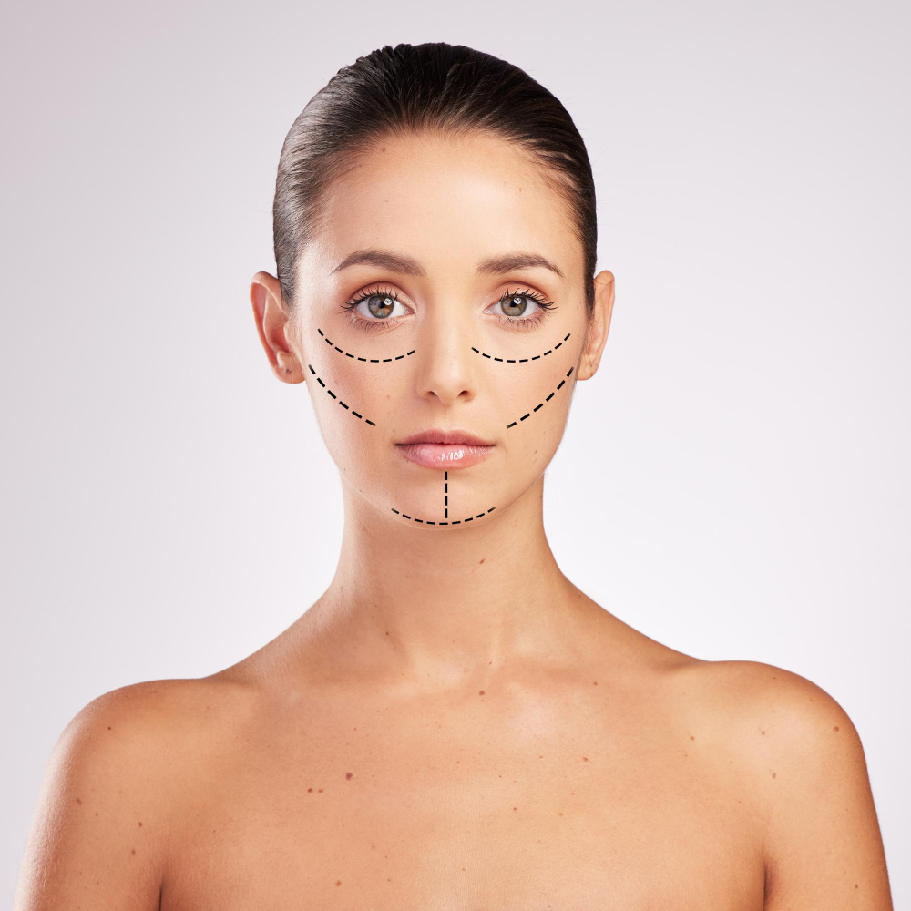 Lifting profond du visage | Correction du relâchement cutané