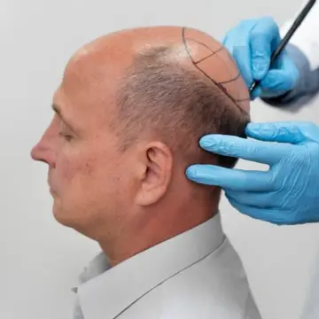 Traitements médicaux en Turquie