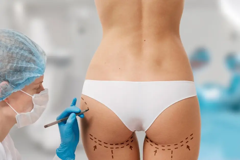Chirurgie d'augmentation des fesses en Turquie