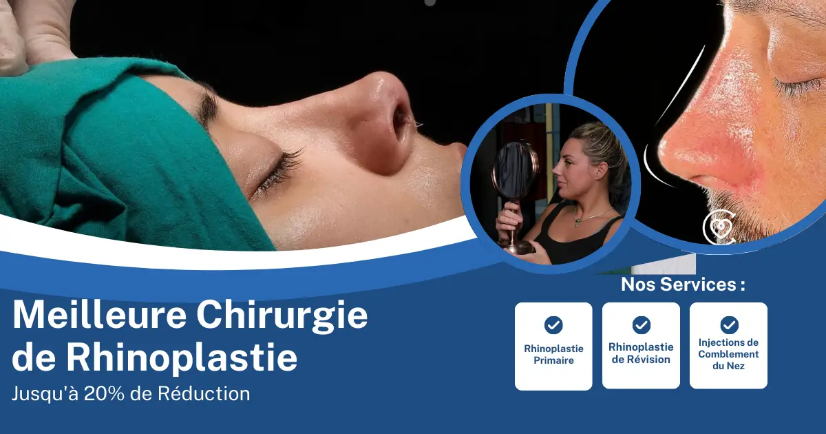 Rhinoplastie en Turquie – Clinique Cayra