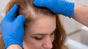 Les avantages de la SMP