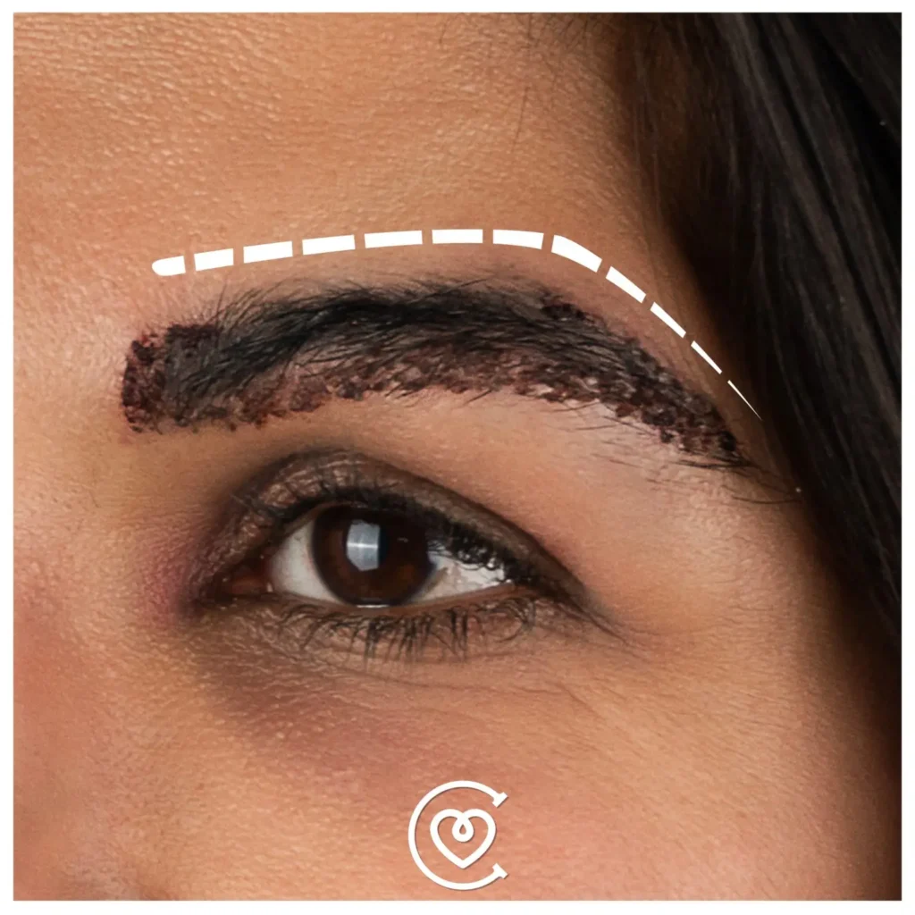 greffe de sourcils turquie