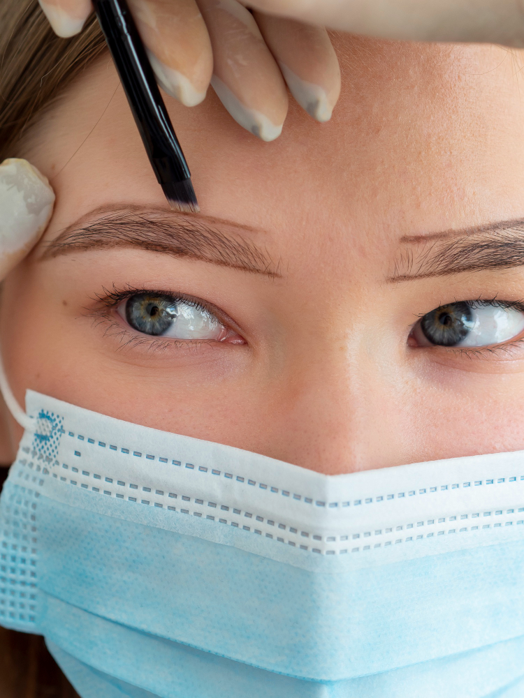 implant sourcils dhi