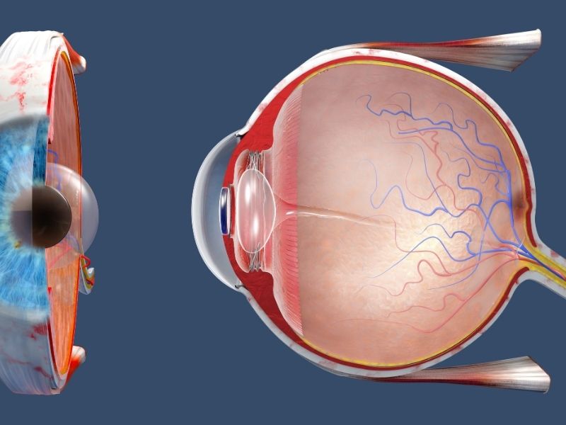 retina cerrahisi nedir