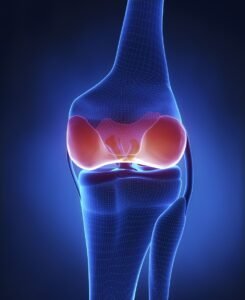 Remplacement du genou : 7 points essentiels à savoir