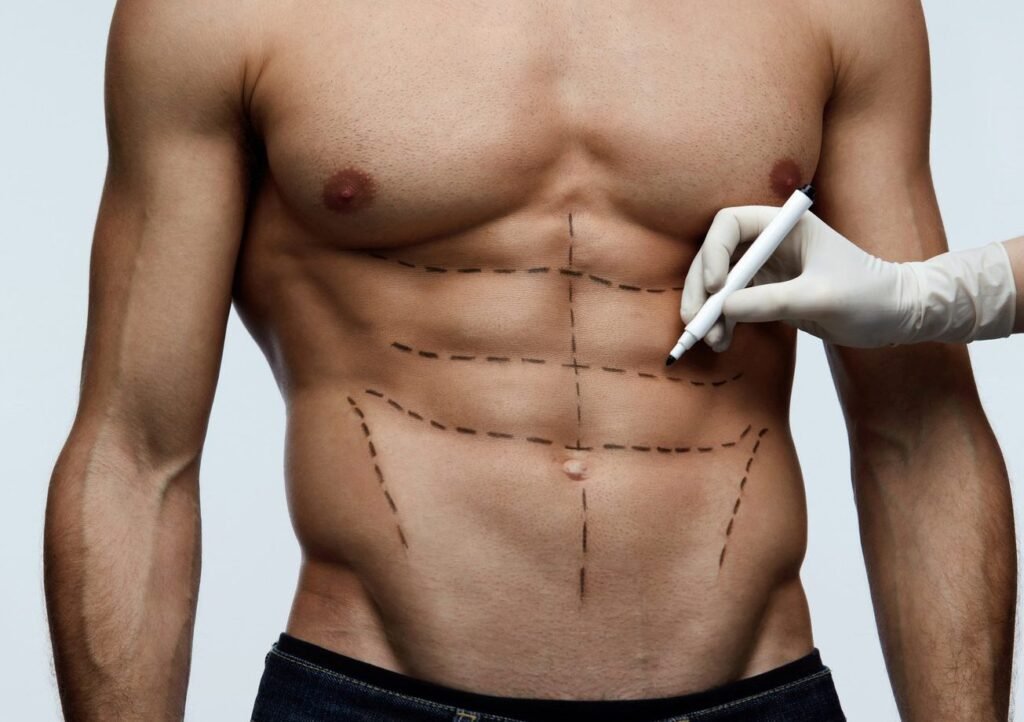 abdominal etching turquie