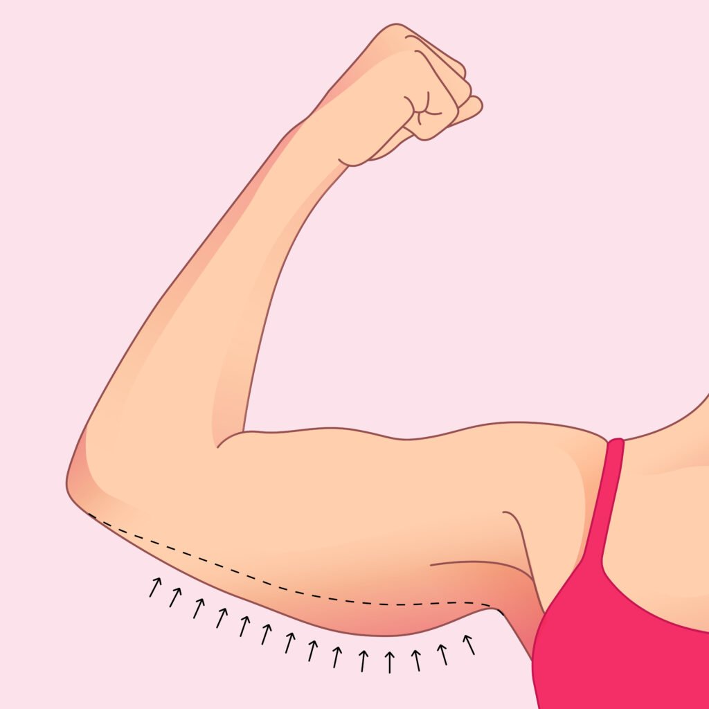 avantages de la liposuccion des bras pour un contour plus harmonieux