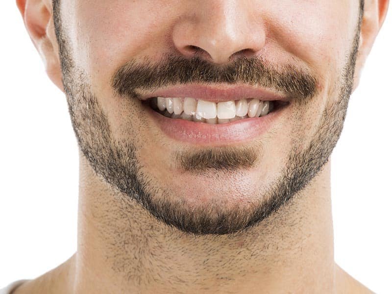 barzdos persodinimas.jpeg