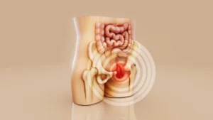 Chirurgie hernie Turquie : 7 avantages clés