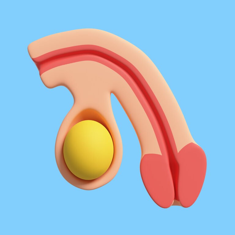 correction de la courbure du pénis avec techniques modernes