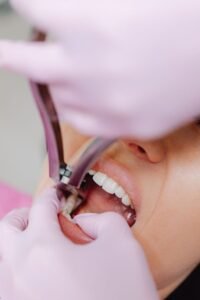 Dents de sagesse Turquie : 7 raisons de choisir l’extraction