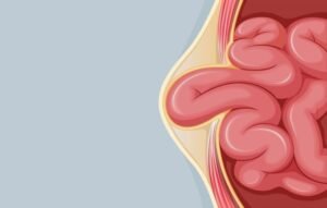 Chirurgie hernie Turquie : 7 avantages clés