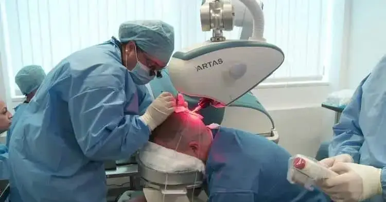 greffe de cheveux robotisée offrant des résultats naturels et précis