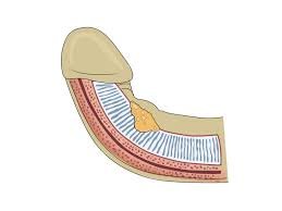 Maladie de La Peyronie : 7 Solutions Efficaces en Turquie