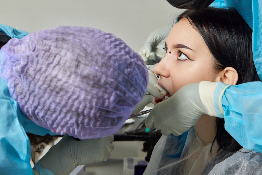 Procédure de sinus lift pour augmenter le volume osseux maxillaire