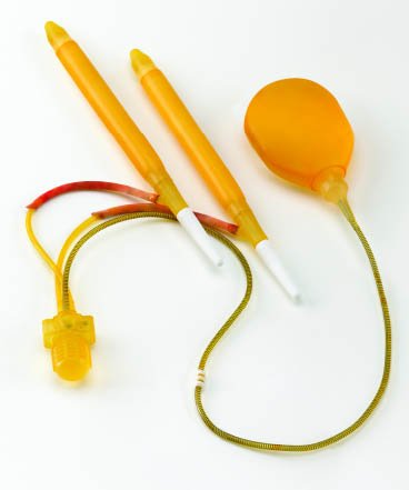 radikal sonrasi penis protezi ameliyati zamanlama ve secim