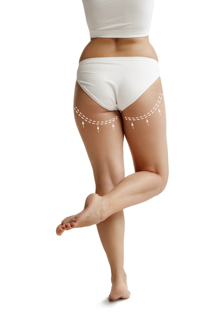 Raffermissement et remodelage des cuisses avec chirurgie