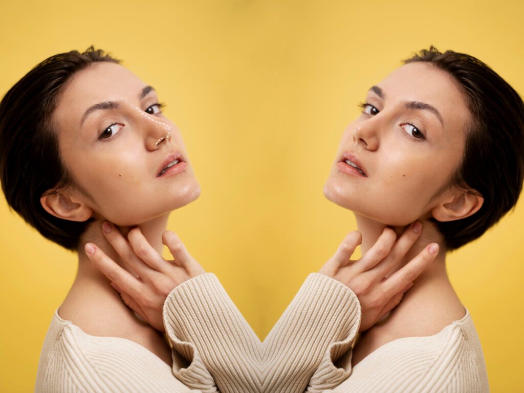 résultat avant et après rhinoplastie corrective