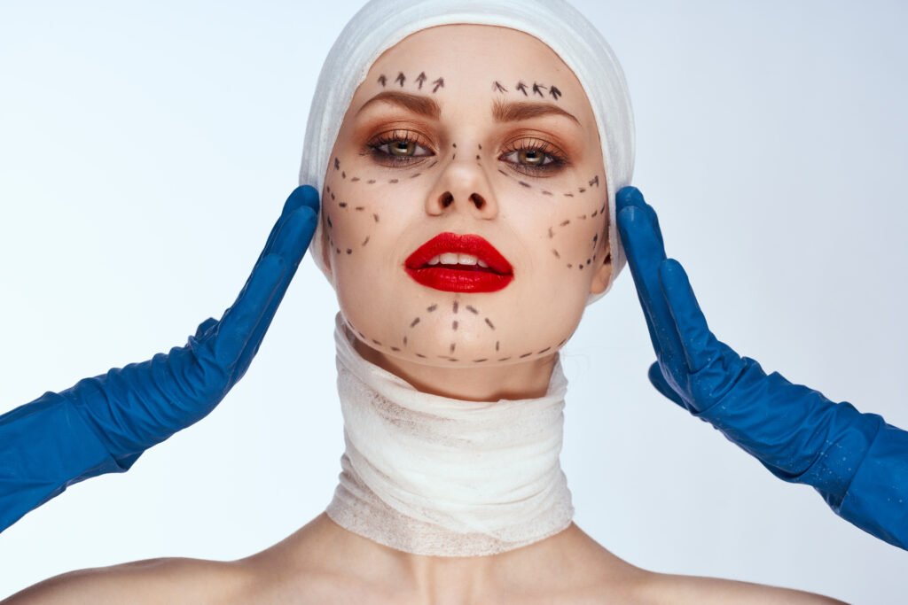 résultats après lifting facial endoscopique pour réduire le relâchement cutané