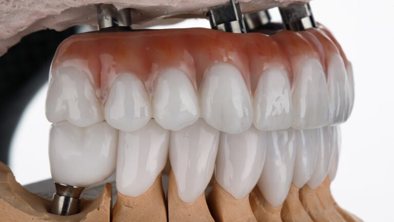 side view of dental prosthesis made of zircon of the upper jaw and crown of the lower jaw on a white background