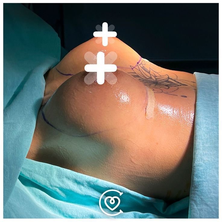 chirurgie esthétique avancée avec résultats naturels et sûrs