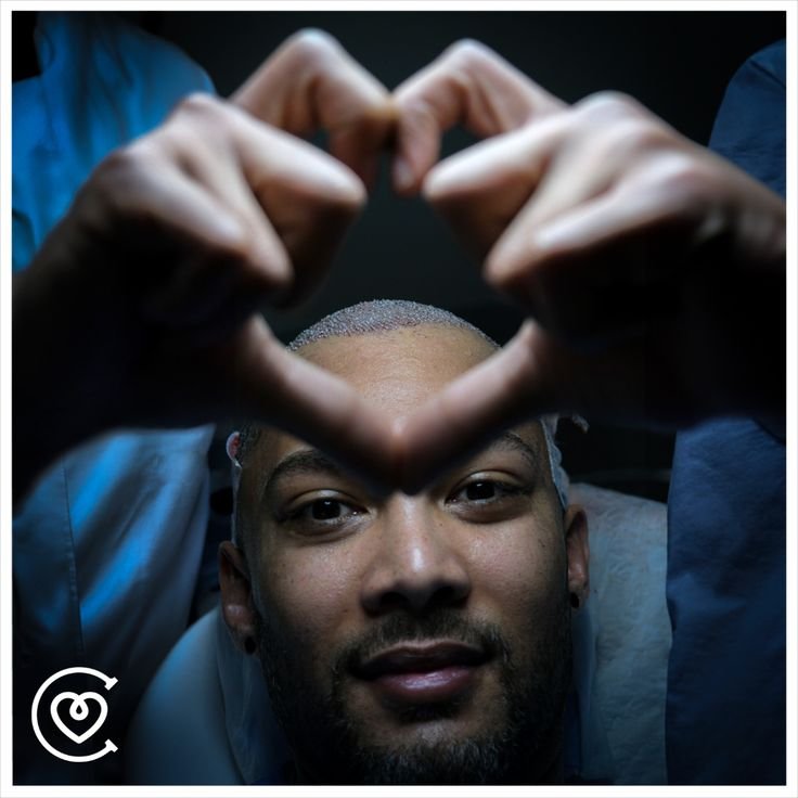 conseils préopératoires pour une transplantation capillaire réussie