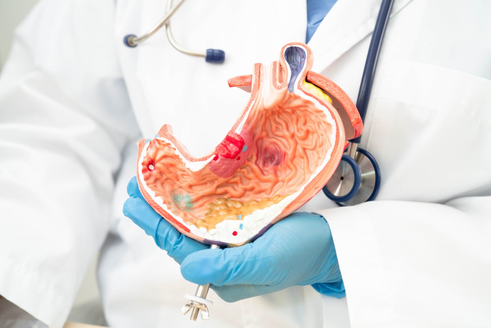 La Turquie est-elle reconnue pour la chirurgie de l’obésité à Cayra Clinics