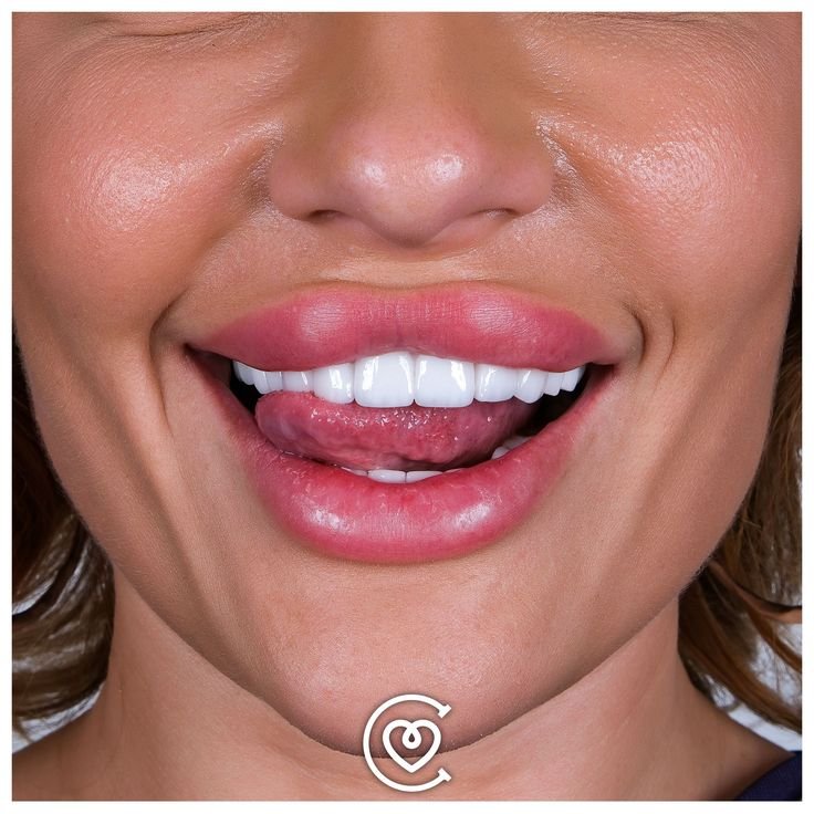 la turquie est elle une destination populaire pour les soins dentaires à cayra clinics