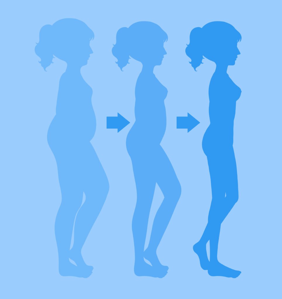 Perte de poids significative et durable après l’intervention