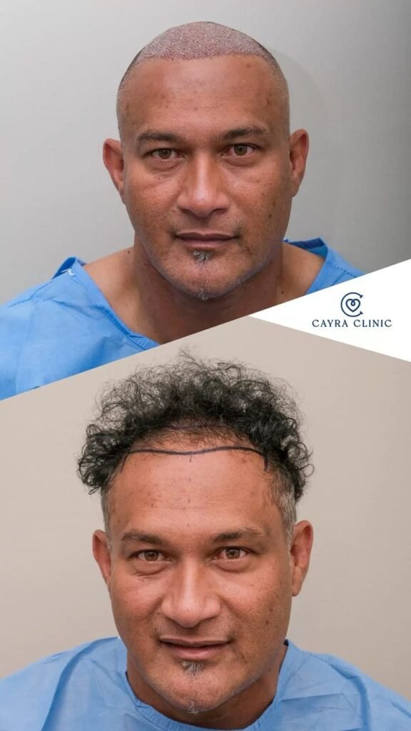 planification complète avant, pendant et après les soins