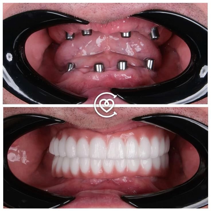 Soins dentaires de haute qualité avec résultats naturels