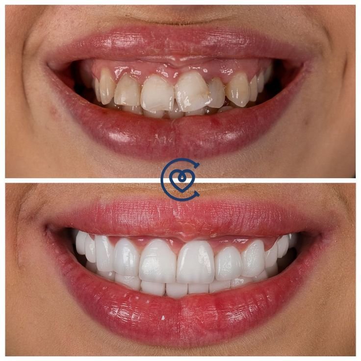 soins dentaires de haute qualité avec résultats naturels