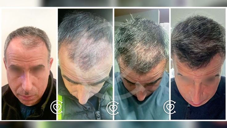 techniques modernes comme fue et dhi pour des résultats naturels