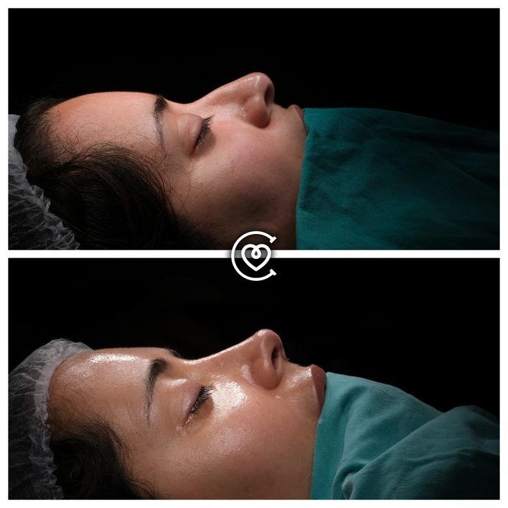 technologies modernes pour des résultats naturels et harmonieux