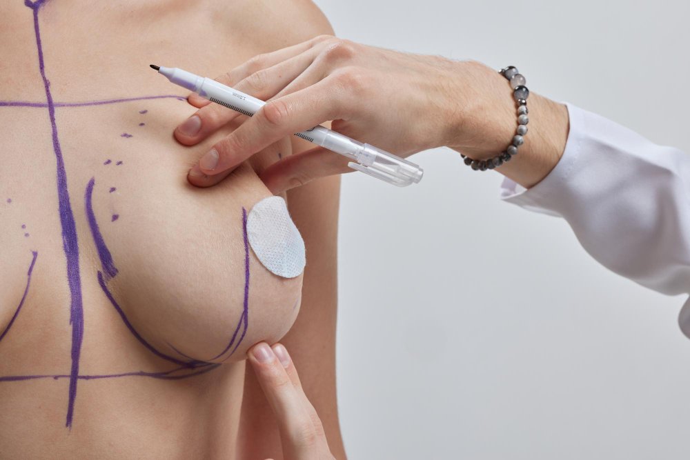 Chirurgie mammaire en Turquie