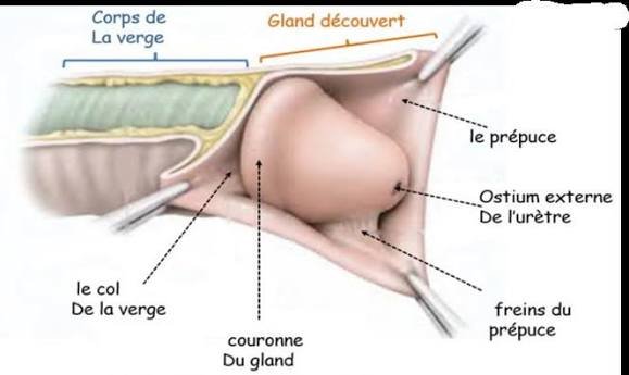 circoncision médicale