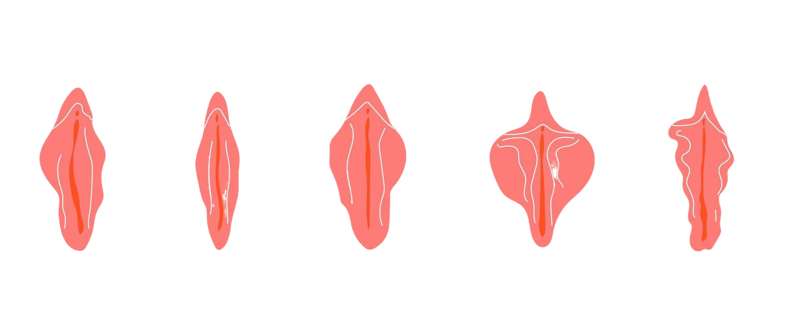 vaginoplastie en Turquie