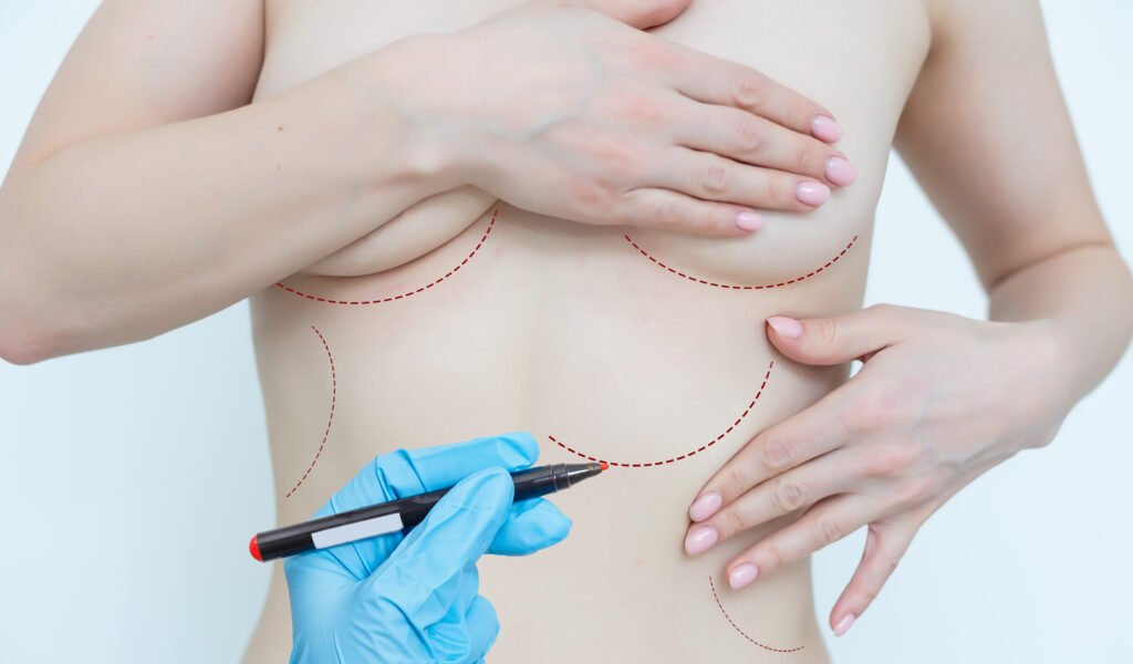 Avantages de combiner une abdominoplastie et un lifting de la poitrine en un seul voyage en Turquie