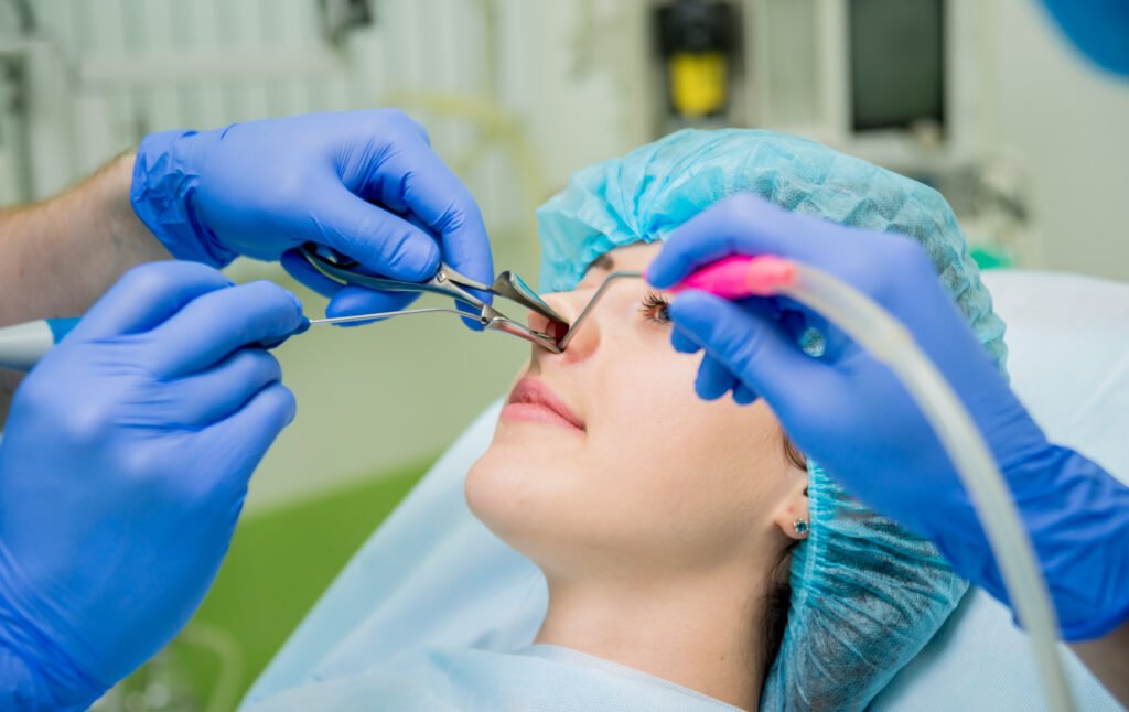 Chirurgie de la pointe du nez pour affiner et remodeler les cartilages