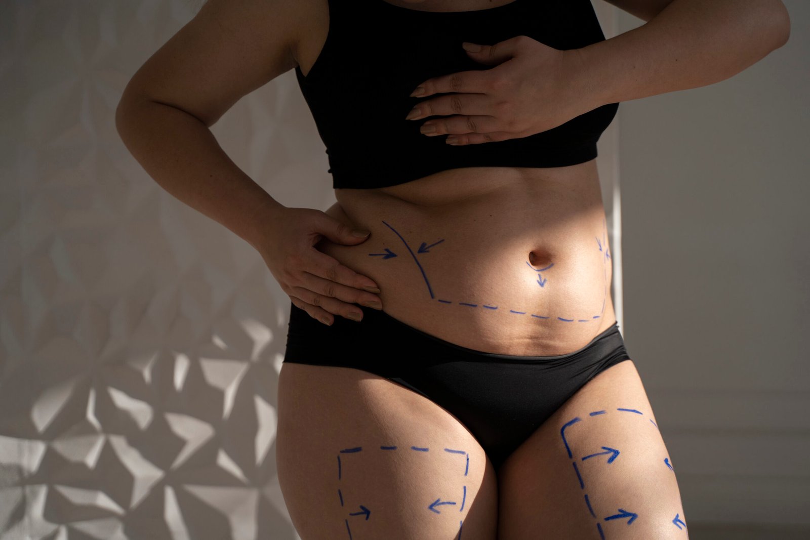 Chirurgie esthétique des seins augmentation et lifting mammaire à Antalya