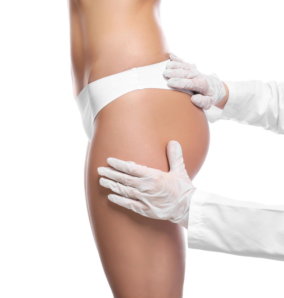 Correction asymétrie fessiers après BBL à Istanbul — Cayra Clinic