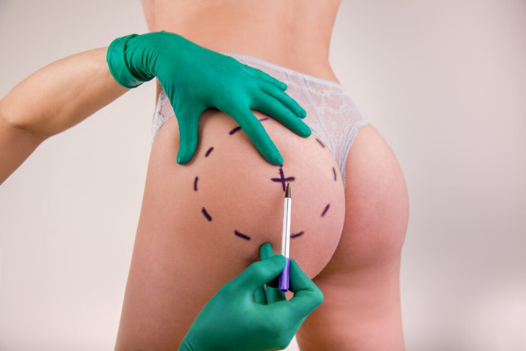 Utilisation du coussin BBL médical pour préserver les cellules graisseuses
