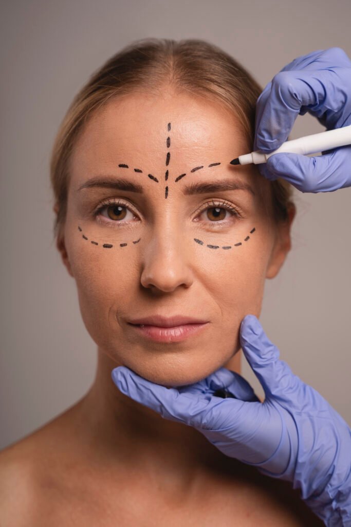 Étapes de l intervention de lifting endoscopique facial en Turquie