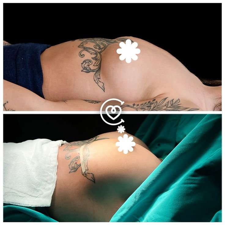 Bilan préopératoire complet et échographie avant chirurgie mammaire