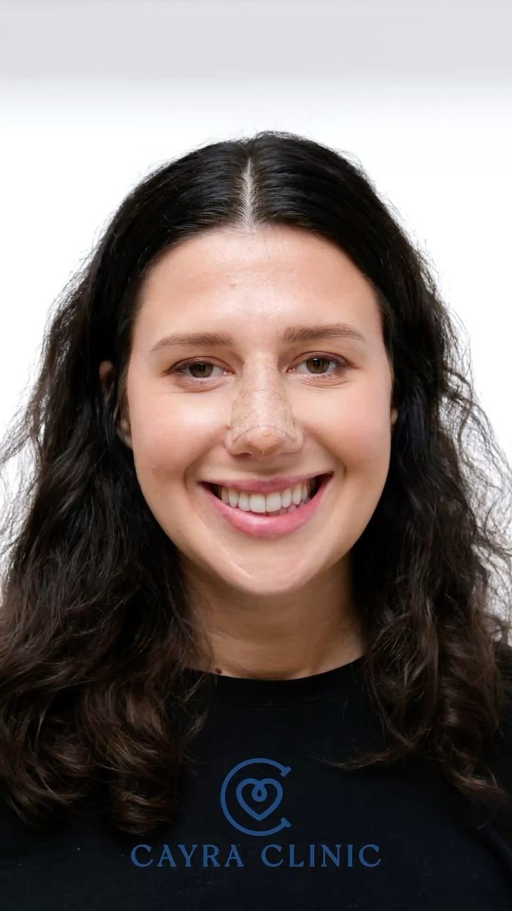 Contrôle médical post-opératoire et retrait de l attelle par le chirurgien