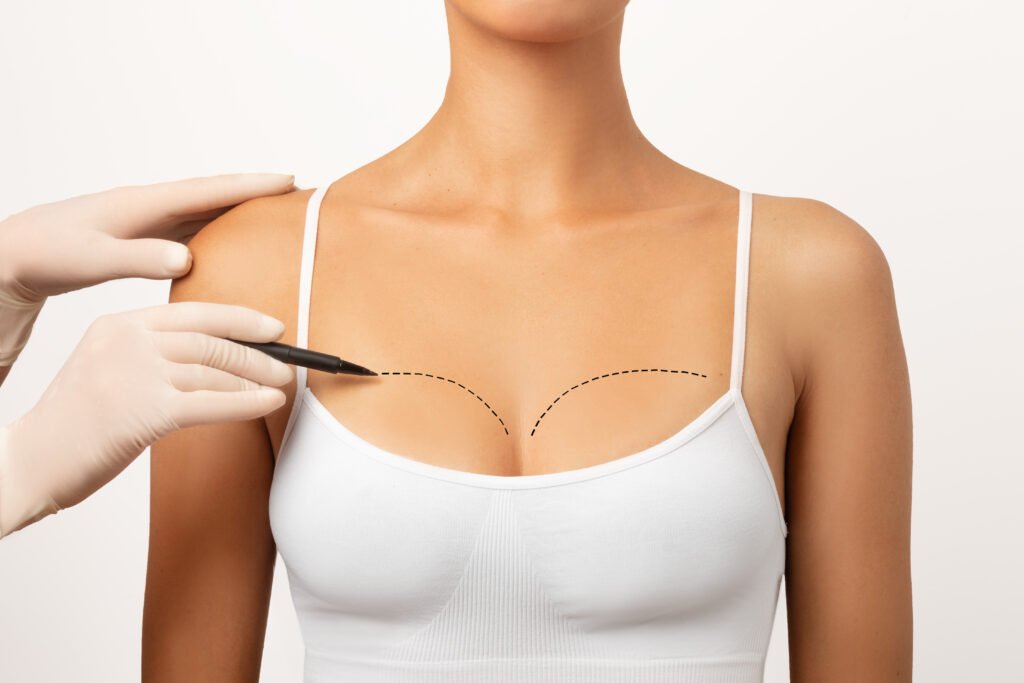 Augmentation mammaire naturelle par lipofilling et réinjection de graisse