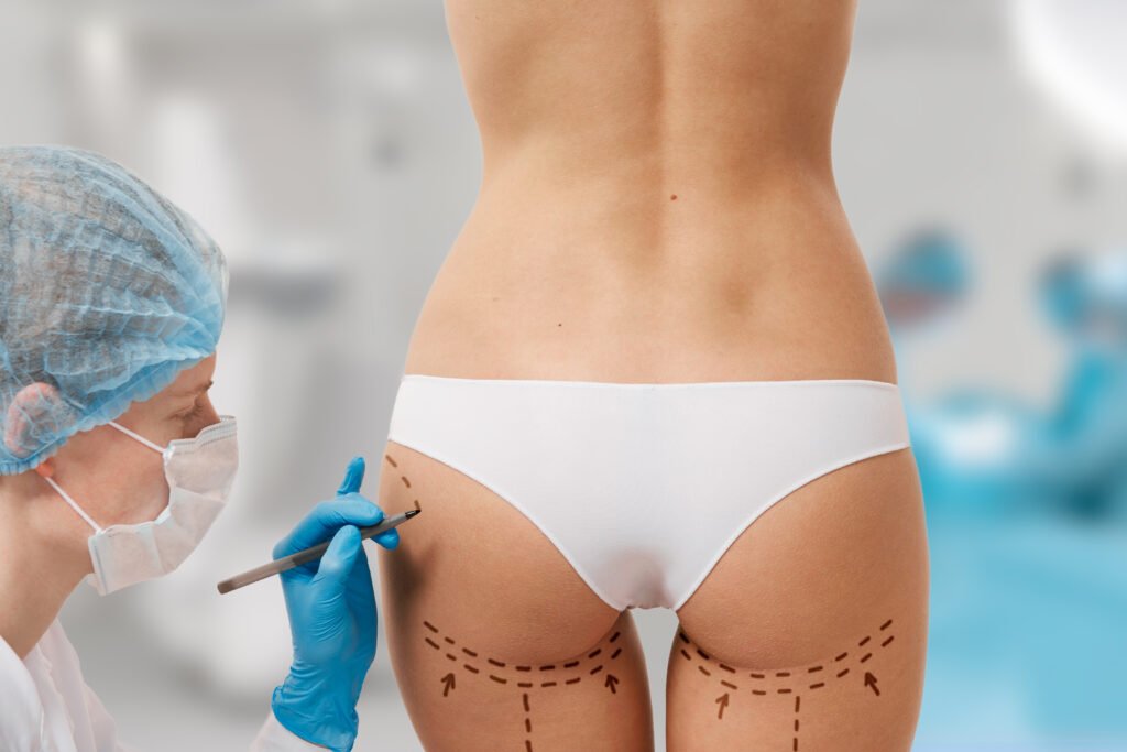 Affinage des cuisses et des genoux par liposuccion ciblée